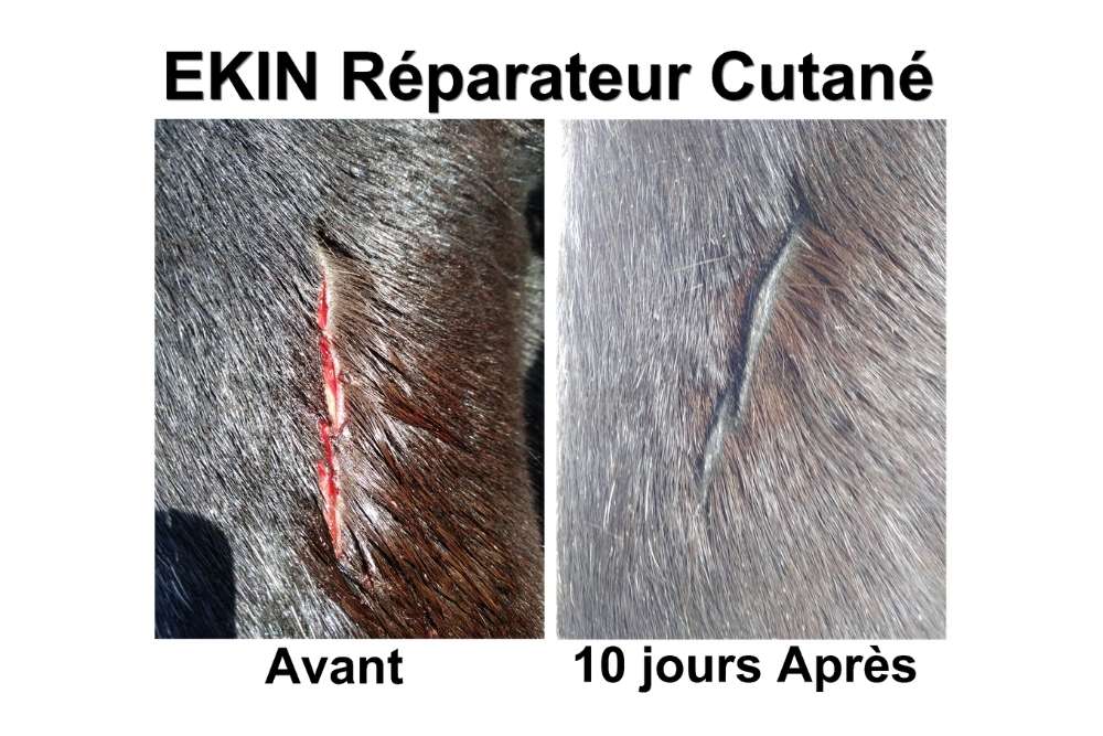 Ekin - Cicatrisation de la peau